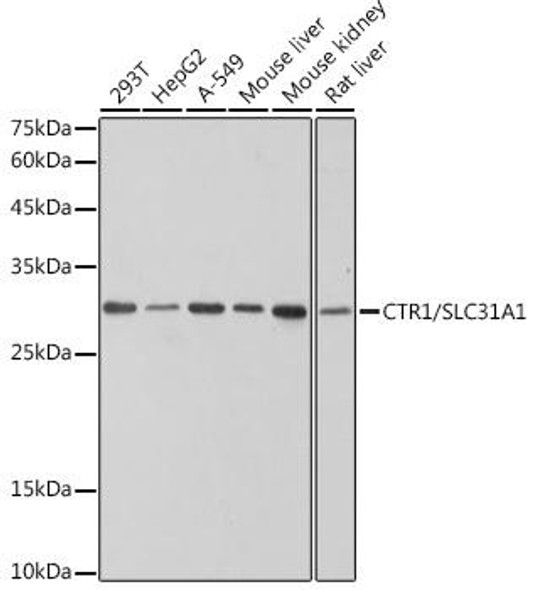 Anti-CTR1/SLC31A1 Antibody (CAB0773)