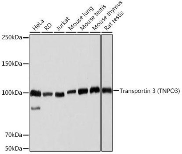 Anti-Transportin 3 (TNPO3) Antibody (CAB19774)