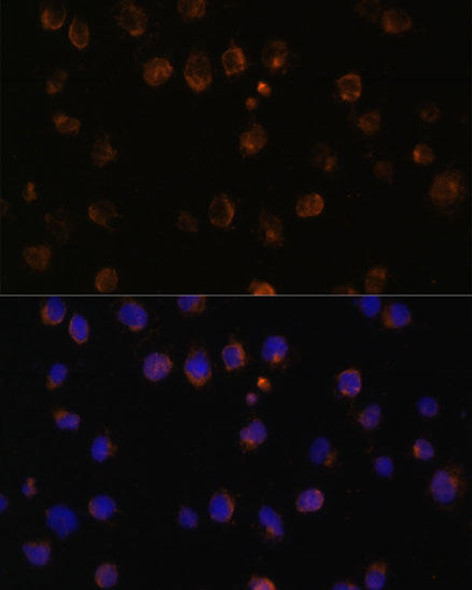 Anti-MyD88 Antibody (CAB0980)