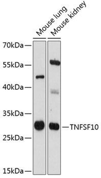 Anti-TNFSF10 Antibody (CAB12064)