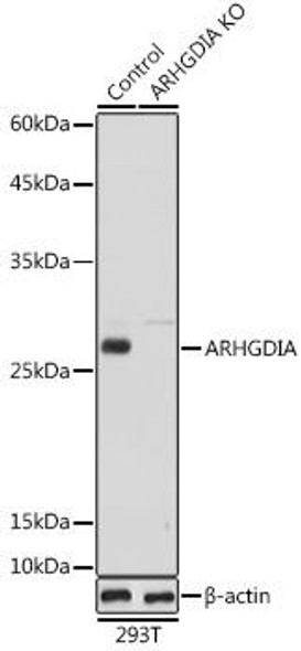 Anti-ARHGDIA Antibody (CAB1214)[KO Validated]