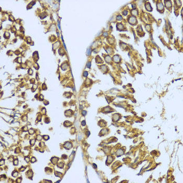 Anti-Hsp90 alpha Antibody (CAB12448)