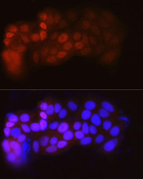 Anti-ESR1 Antibody (CAB12976)