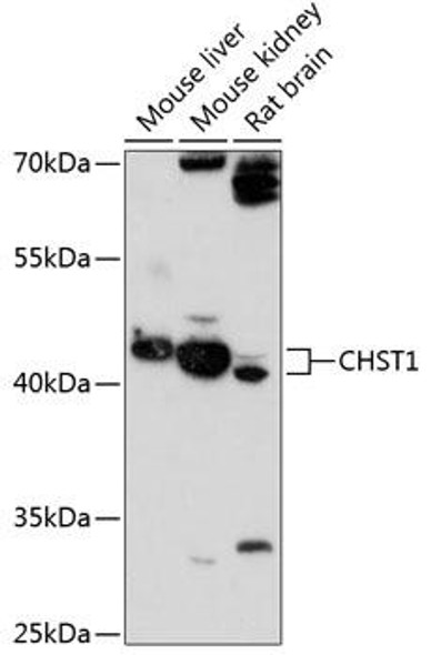 Anti-CHST1 Antibody (CAB13057)