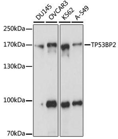 Anti-TP53BP2 Antibody (CAB15105)