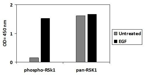 Human Phospho-RSK1 (S380) and Total RSK1 PharmaGenie ELISA Kit (SBRS1956)