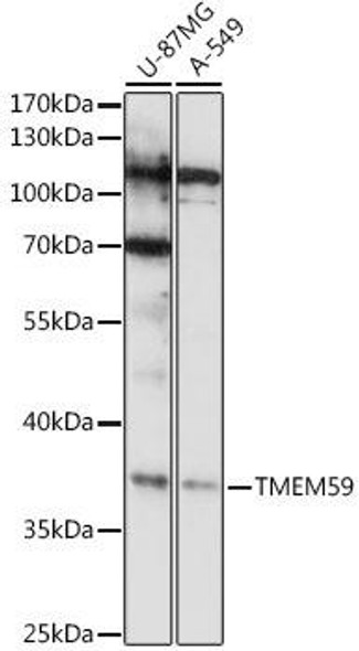 Anti-TMEM59 Antibody (CAB16089)
