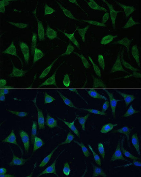 Anti-LSM14A Antibody (CAB16682)