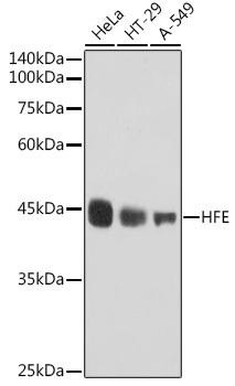HFE Rabbit Monoclonal Antibody (CAB0937)