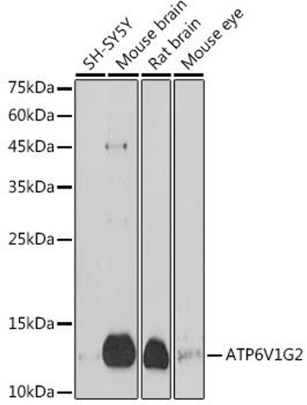 ATP6V1G2 Rabbit Polyclonal Antibody (CAB20163)