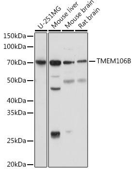 TMEM106B Rabbit Polyclonal Antibody (CAB20165)