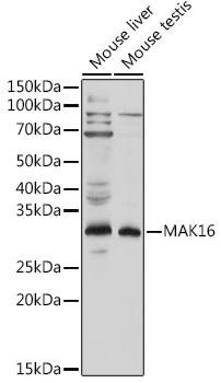 MAK16 Rabbit Polyclonal Antibody (CAB20182)