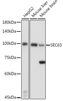 SEC63 Rabbit Polyclonal Antibody (CAB20554)