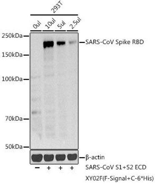 SARS-CoV Spike RBD Rabbit Polyclonal Antibody (CAB20606)