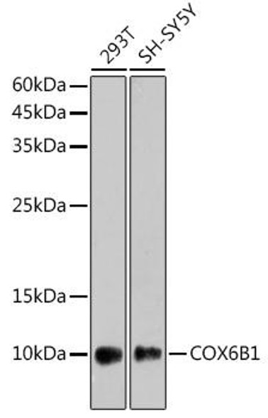 COX6B1 Rabbit Monoclonal Antibody (CAB2228)