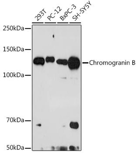 Chromogranin B Rabbit Monoclonal Antibody (CAB3517)
