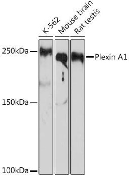 Plexin A1 Rabbit Monoclonal Antibody (CAB3698)