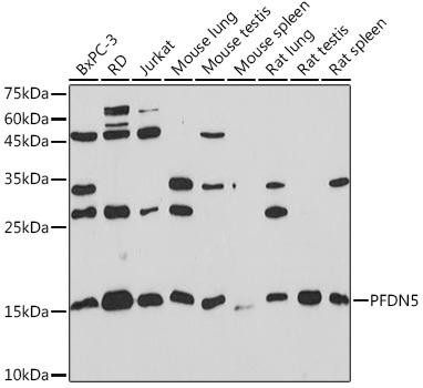 PFDN5 Rabbit Monoclonal Antibody (CAB4101)