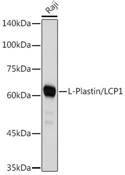 Plastin L Rabbit Monoclonal Antibody (CAB4664)