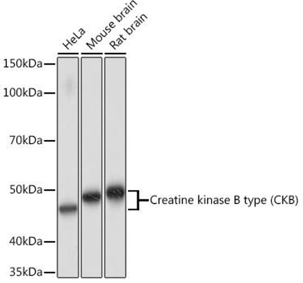 Creatine kinase B type (CKB) Rabbit Monoclonal Antibody (CAB4907)