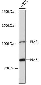 PMEL Rabbit Polyclonal Antibody (CAB5384)