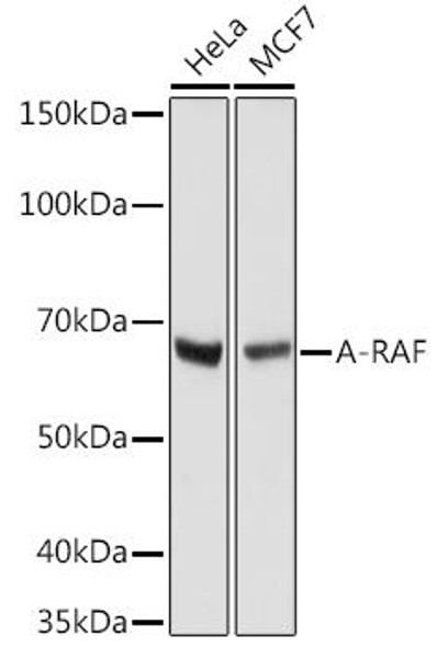 A-RAF Rabbit Monoclonal Antibody (CAB8687)