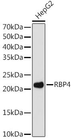 RBP4 Rabbit Monoclonal Antibody (CAB8807)