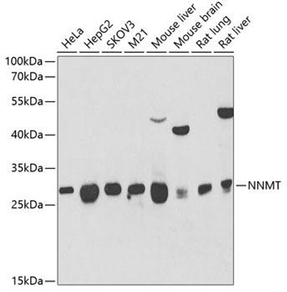 Anti-NNMT Antibody (CAB6673)