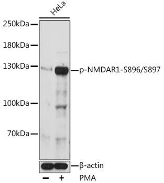Phospho-NMDAR1-S896/S897 Rabbit Polyclonal Antibody (CABP0962)