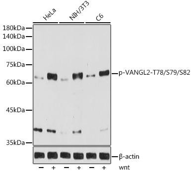 Anti-Phospho-VANGL2-T78/S79/S82 Antibody (CABP1206)