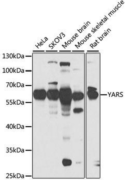 Anti-YARS Antibody (CAB6791)