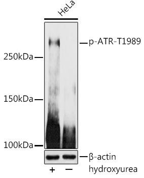 Phospho-ATR-T1989 Rabbit Polyclonal Antibody (CABP1248)