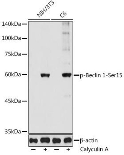 Phospho-Beclin 1-Ser15 Rabbit Polyclonal Antibody (CABP1252)