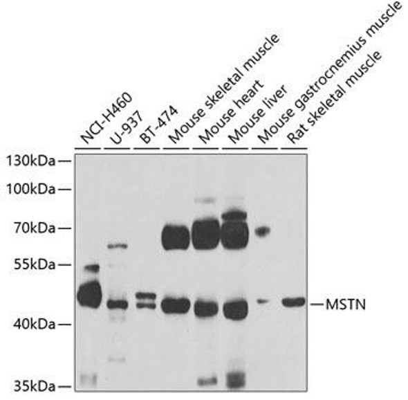 Anti-MSTN Antibody (CAB6913)