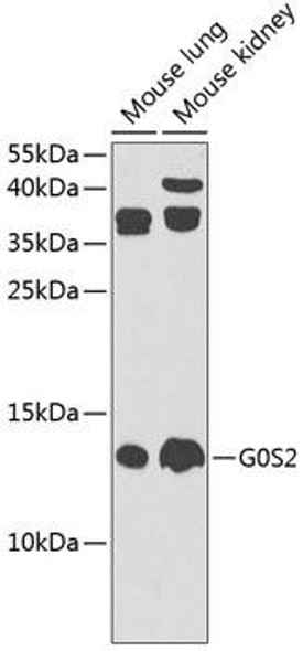 Anti-G0S2 Antibody (CAB9970)