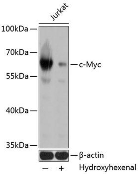 Anti-c-Myc Mouse Monoclonal Antibody (CAB11029)