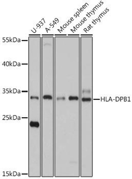 Anti-HLA-DPB1 Antibody (CAB17495)