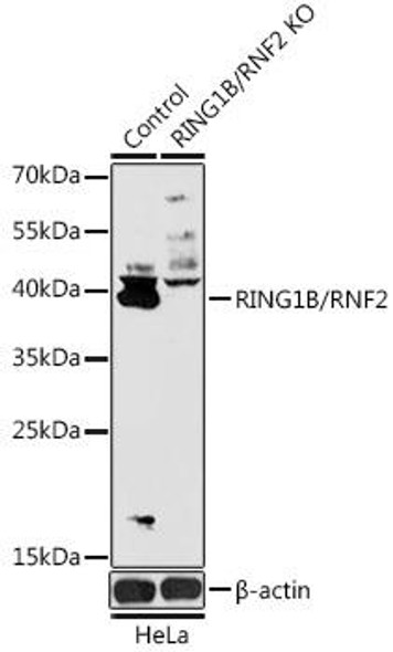 Anti-RING1B/RNF2 Antibody (CAB18076)[KO Validated]