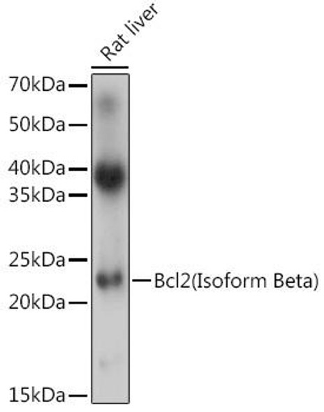Anti-Bcl2(Isoform Beta) Antibody (CAB18415)