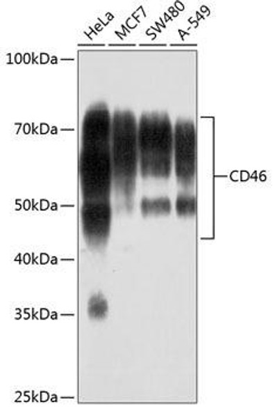 Anti-CD46 Antibody (CAB19022)