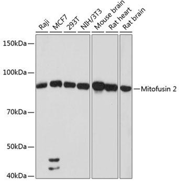 Anti-Mitofusin 2 Antibody (CAB19678)