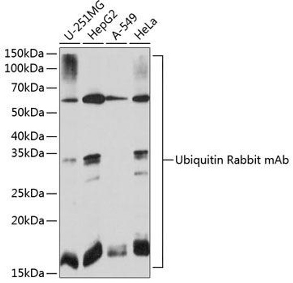 Anti-Ubiquitin Antibody (CAB19686)