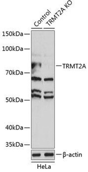 Anti-TRMT2A Antibody (CAB19987)[KO Validated]