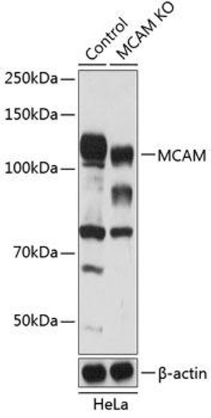 Anti-MCAM Antibody (CAB19993)[KO Validated]