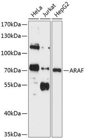 Anti-ARAF Antibody (CAB0180)