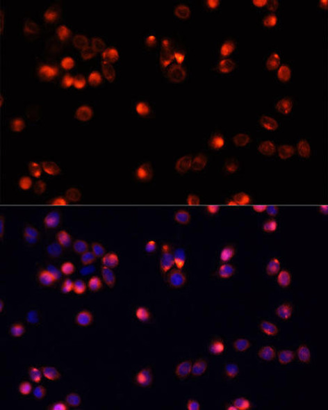 Anti-AKT2 Antibody (CAB0336)