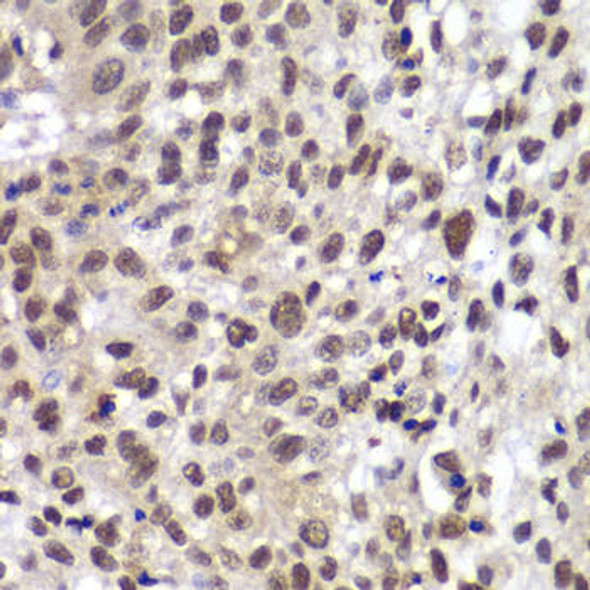 Anti-Chk2 Antibody (CAB0466)