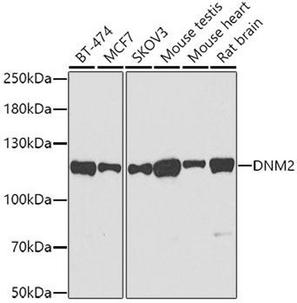 Anti-DNM2 Antibody (CAB0523)