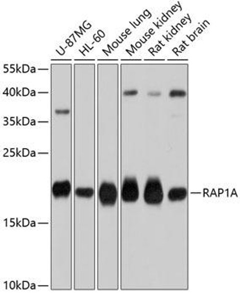 Anti-RAP1A Antibody (CAB0975)