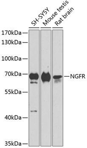 Anti-NGFR Antibody (CAB11169)